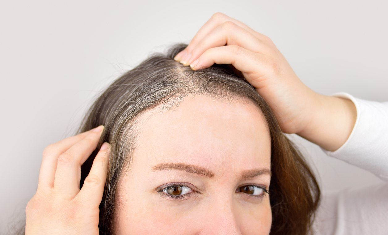 Goodbye to gray hair and hair loss with baking soda! Health. Pharmamedic