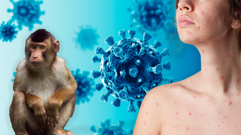 OMS: Il virus Mpox dichiarato emergenza pubblica