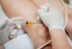 Terapia células madre, Stem cell therapy, cura cellule staminali