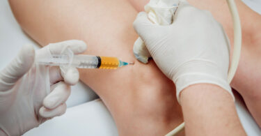 Terapia células madre, Stem cell therapy, cura cellule staminali