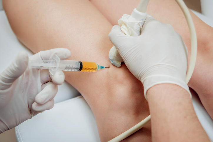 Terapia células madre, Stem cell therapy, cura cellule staminali